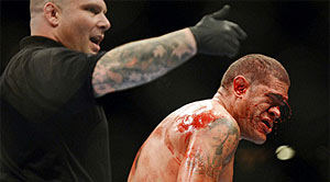 ufc-bloodiest-thumb